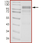 EGFR, Active with mCherry